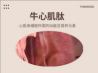 【品牌】：郁旺达（量子饱和植入产品）