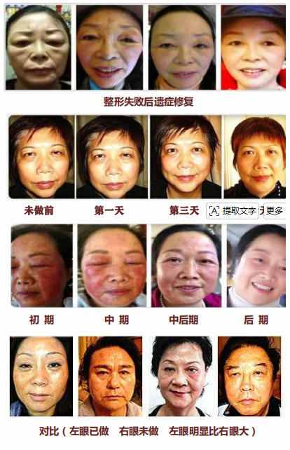 生命能量神石荣获国家科技成果奖，开启能量医学养生新征程