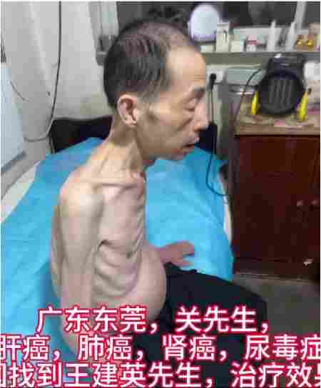 八一专题报道 新时代国医名师---王建英
