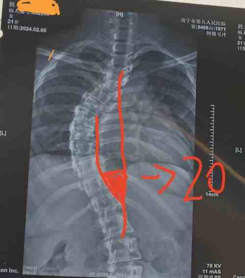 宫廷整脊正骨：王洪喜与通脉整骨堂的百年非遗传承之路