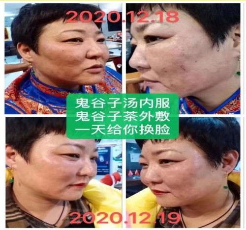 承鬼谷子道医智慧， 以“平火、祝由”破当代健康困局