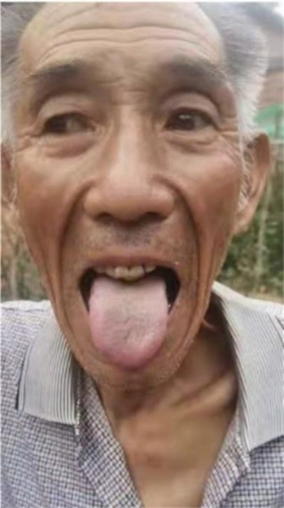 古稀仁医守扶阳正道 妙手回春解百姓疾苦——记山西运城绛县老中医孙政权