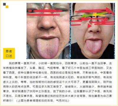 古稀仁医守扶阳正道 妙手回春解百姓疾苦——记山西运城绛县老中医孙政权